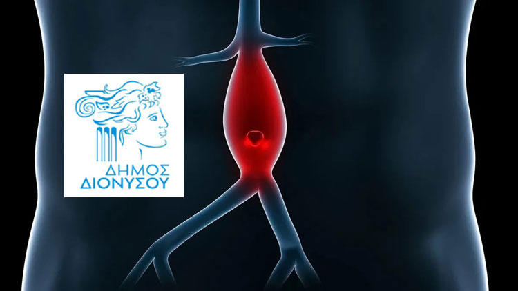 Δωρεάν εξέταση για ανεύρυσμα κοιλιακής αορτής από το Δήμο Διονύσου την Τετάρτη 1 και την Πέμπτη 2/3