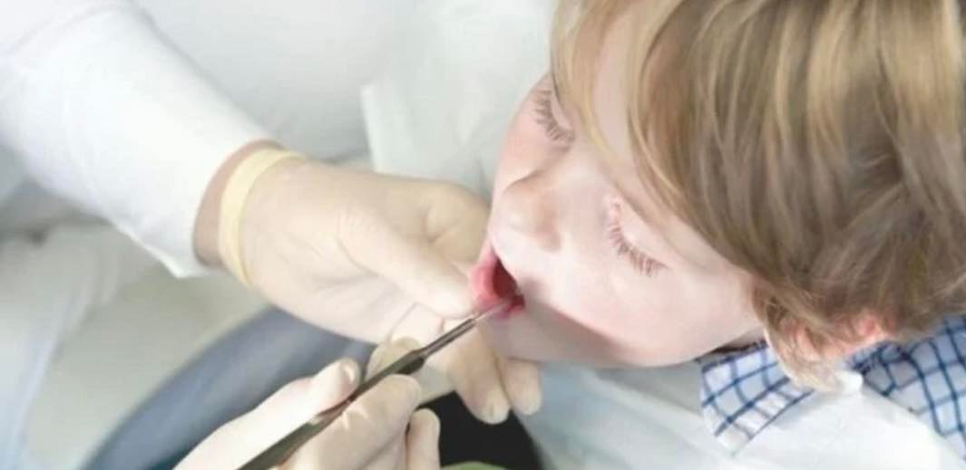 Dentist Pass: Τι είναι και πώς θα λειτουργεί – Πότε θα το πάρουν οι γονείς