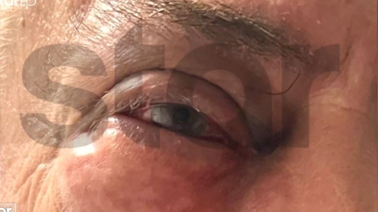 Γλυφάδα: Οικονομικές διαφορές 6 εκατ. ευρώ είχε ο επιχειρηματίας που κατήγγειλε ξυλοδαρμό από τον Ισραηλινό πρώην συνέταιρό του