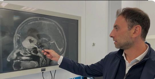 Έλληνας γιατρός στην Σκωτία εξέλιξε επαναστατική τεχνική – Αφαιρεί όγκους από τον εγκέφαλο μέσω των φρυδιών χωρίς κρανιεκτομή