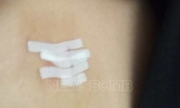 Αρτέμιδα: Τη μαχαίρωσε, τη χτύπησε, ανέβασε «ροζ» βίντεό της στο διαδίκτυο και παραμένει ασύλληπτος