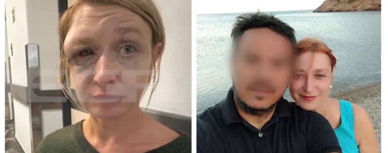 Κορωπί: "Δεν νομίζω να με χτύπησε ο σύντροφός μου, κακώς τον συνέλαβαν" - Η 40χρονη "αθωώνει" τον 50χρονο