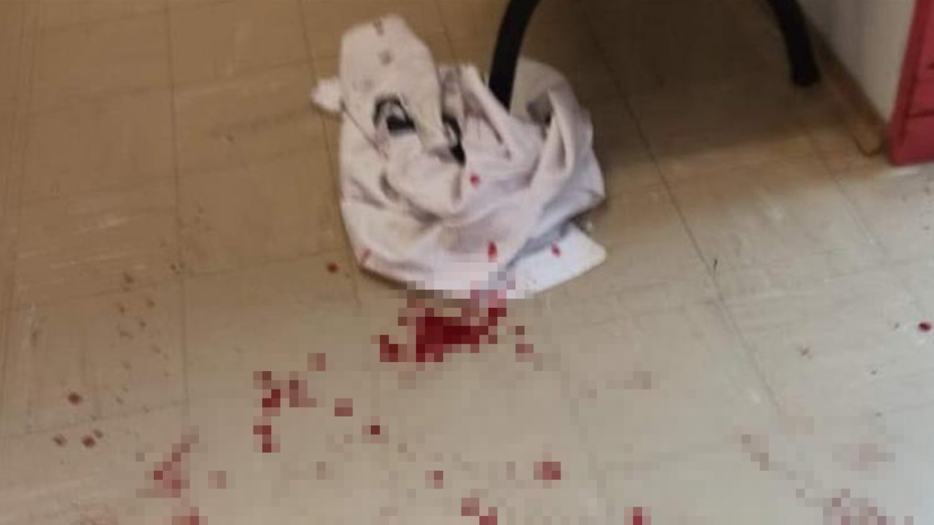 Ρομά διέλυσαν το Κέντρο Υγείας στα Σπάτα και επιτέθηκαν σε γιατρό, φύλακα και αστυνομικούς