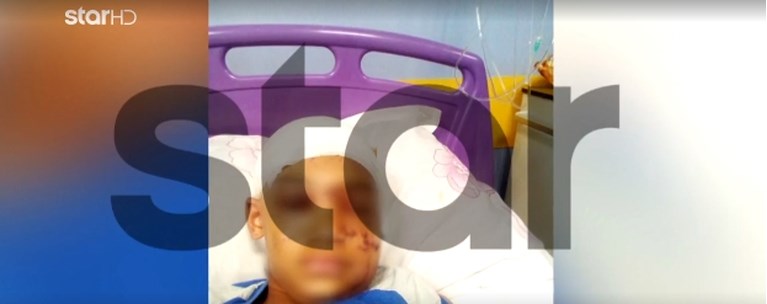 Λούτσα: Χειρουργήθηκε ο 11χρονος που τον δάγκωσε πιτ μπουλ - "Έβαλε τέσσερις φορές το χέρι του στο στόμα του σκύλου"